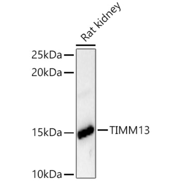 Western Blot - Anti-TIMM13 Antibody (A329894) - Antibodies.com