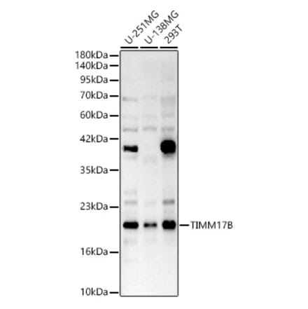Western Blot - Anti-TIMM17B Antibody (A329895) - Antibodies.com