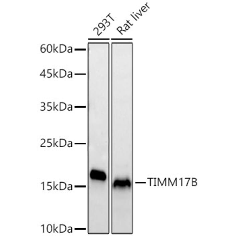Western Blot - Anti-TIMM17B Antibody [ARC65362] (A329896) - Antibodies.com