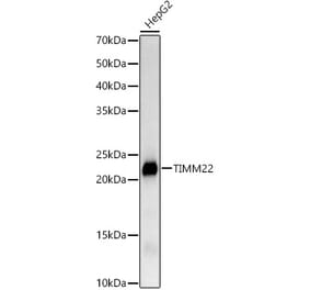Western Blot - Anti-TIMM22 Antibody [ARC3118] (A329897) - Antibodies.com