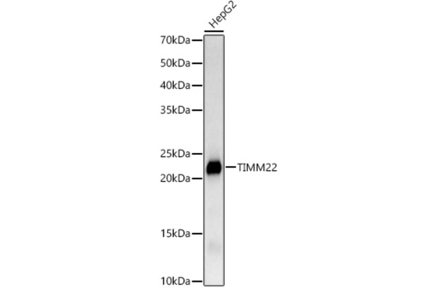 Western Blot - Anti-TIMM22 Antibody [ARC3118] (A329897) - Antibodies.com