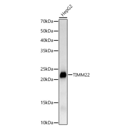 Western Blot - Anti-TIMM22 Antibody [ARC3118] (A329897) - Antibodies.com