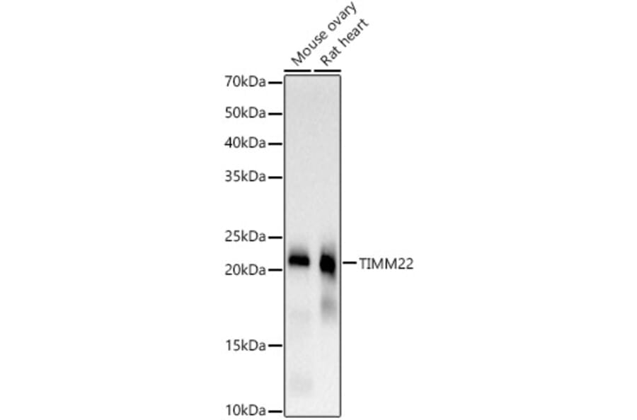 Western Blot - Anti-TIMM22 Antibody [ARC3118] (A329897) - Antibodies.com