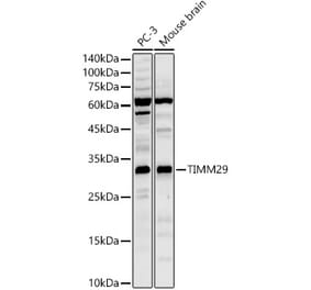 Western Blot - Anti-TIMM29 Antibody (A329898) - Antibodies.com