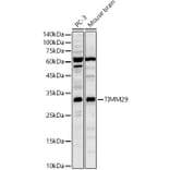 Western Blot - Anti-TIMM29 Antibody (A329898) - Antibodies.com