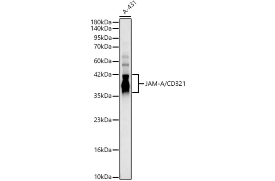 Western Blot - Anti-TIP60 Antibody (A329899) - Antibodies.com