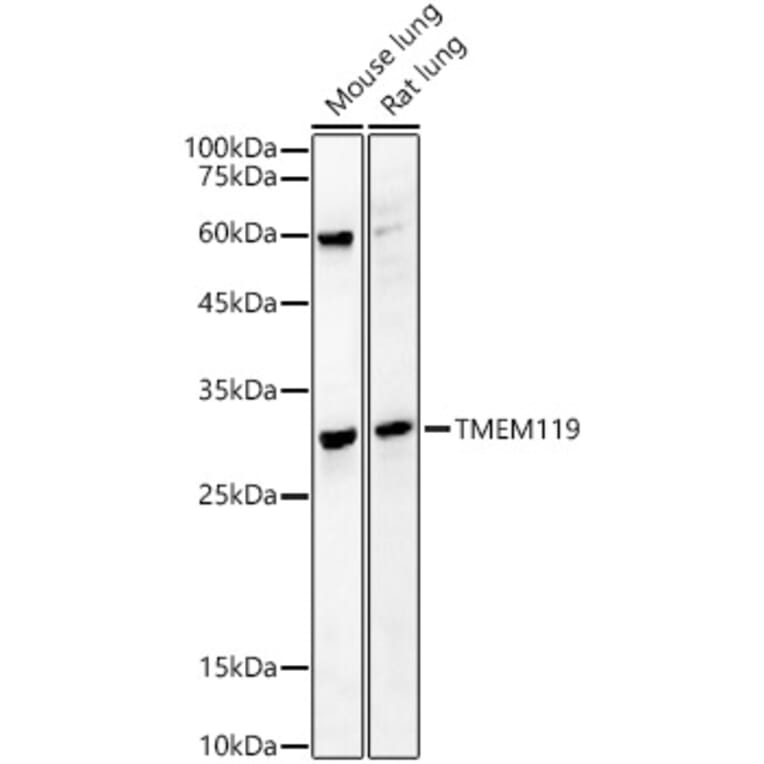 Western Blot - Anti-TMEM119 Antibody (A329905) - Antibodies.com