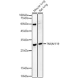 Western Blot - Anti-TMEM119 Antibody (A329905) - Antibodies.com