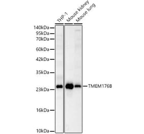Western Blot - Anti-TMEM176B Antibody (A329906) - Antibodies.com