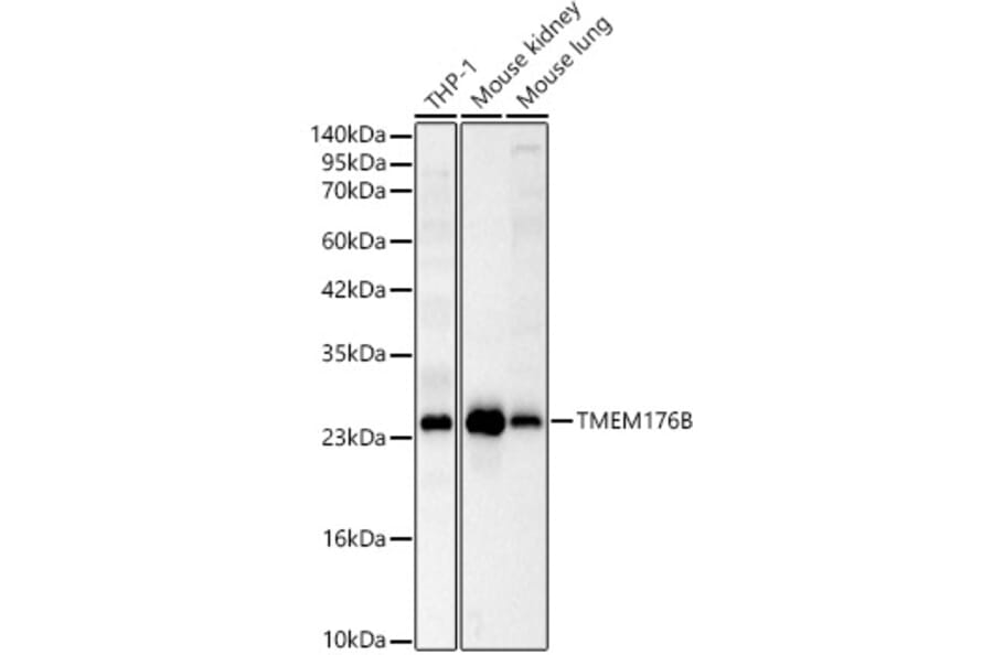Western Blot - Anti-TMEM176B Antibody (A329906) - Antibodies.com