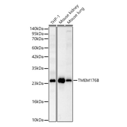 Western Blot - Anti-TMEM176B Antibody (A329906) - Antibodies.com