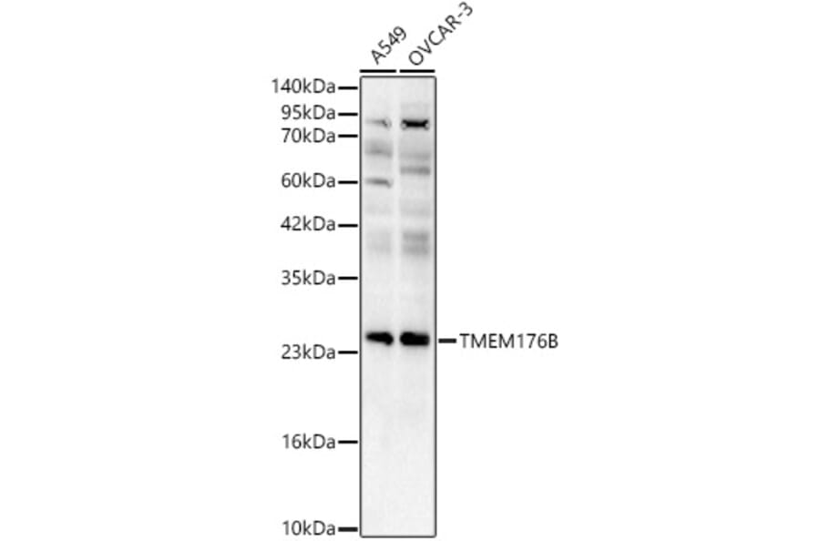 Western Blot - Anti-TMEM176B Antibody (A329906) - Antibodies.com
