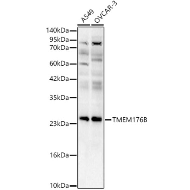 Western Blot - Anti-TMEM176B Antibody (A329906) - Antibodies.com