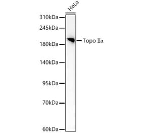 Western Blot - Anti-TOP2A Antibody (A329922) - Antibodies.com