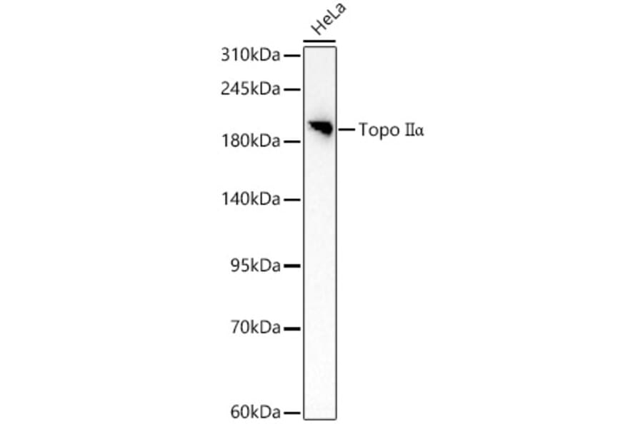 Western Blot - Anti-TOP2A Antibody (A329922) - Antibodies.com