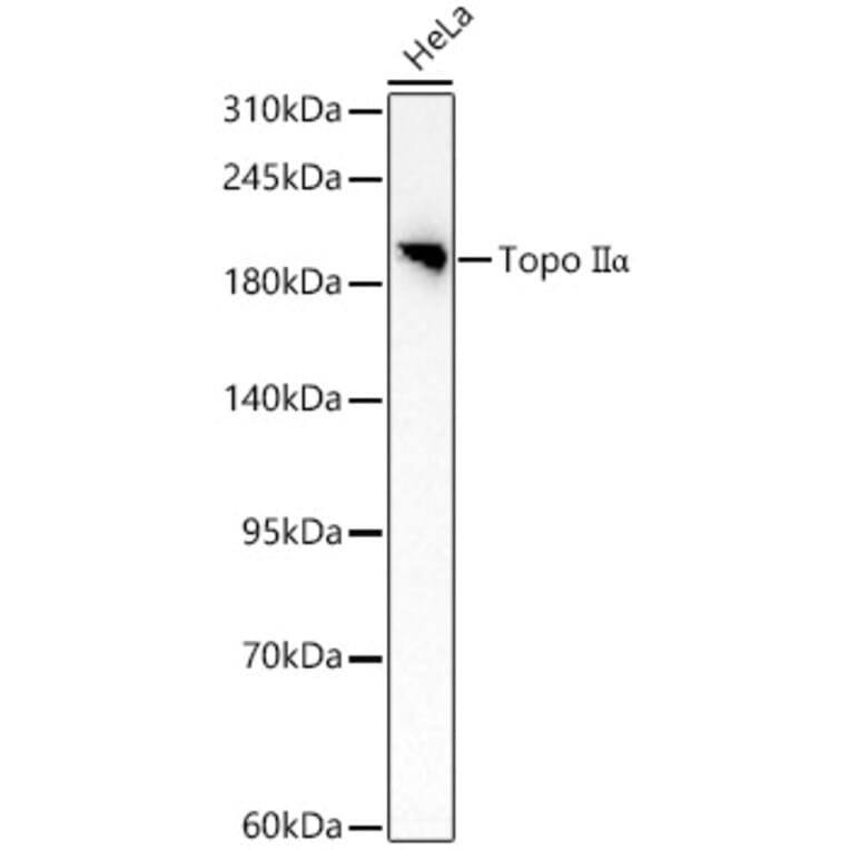 Western Blot - Anti-TOP2A Antibody (A329922) - Antibodies.com
