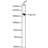 Western Blot - Anti-TOP2A Antibody (A329922) - Antibodies.com