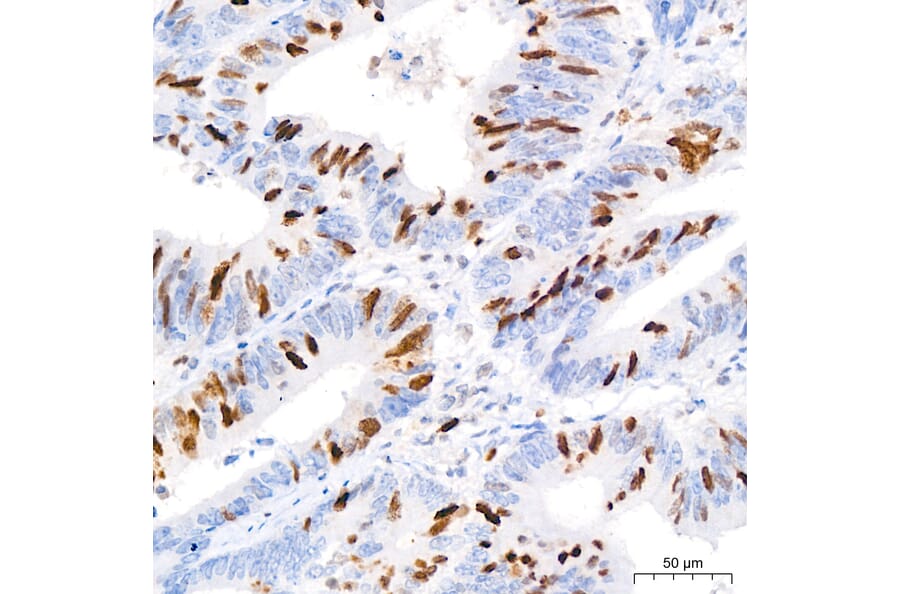 Immunohistochemistry - Anti-TOP2A Antibody (A329922) - Antibodies.com