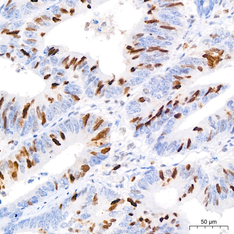 Immunohistochemistry - Anti-TOP2A Antibody (A329922) - Antibodies.com