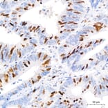 Immunohistochemistry - Anti-TOP2A Antibody (A329922) - Antibodies.com