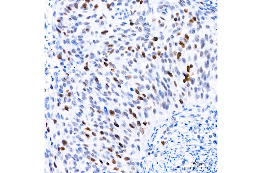 Immunohistochemistry - Anti-TOP2A Antibody (A329922) - Antibodies.com