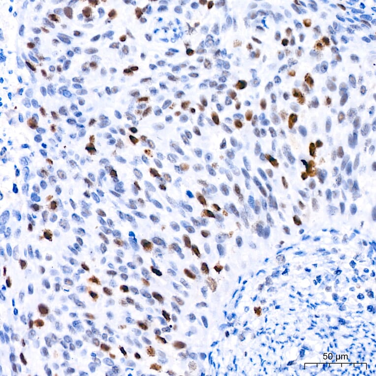 Immunohistochemistry - Anti-TOP2A Antibody (A329922) - Antibodies.com