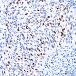 Immunohistochemistry - Anti-TOP2A Antibody (A329922) - Antibodies.com