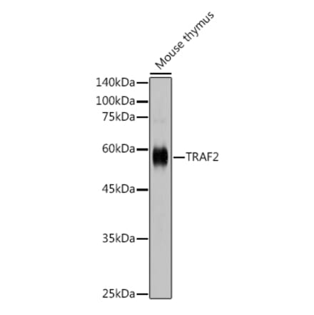 Western Blot - Anti-TRAF2 Antibody (A329923) - Antibodies.com