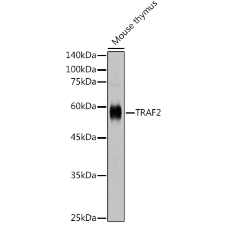 Western Blot - Anti-TRAF2 Antibody (A329923) - Antibodies.com