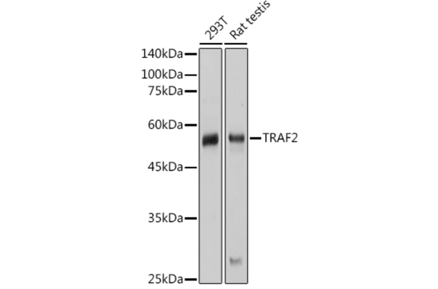Western Blot - Anti-TRAF2 Antibody (A329923) - Antibodies.com