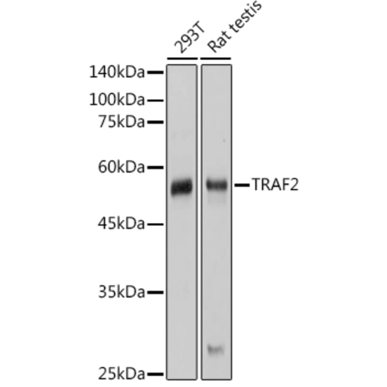 Western Blot - Anti-TRAF2 Antibody (A329923) - Antibodies.com