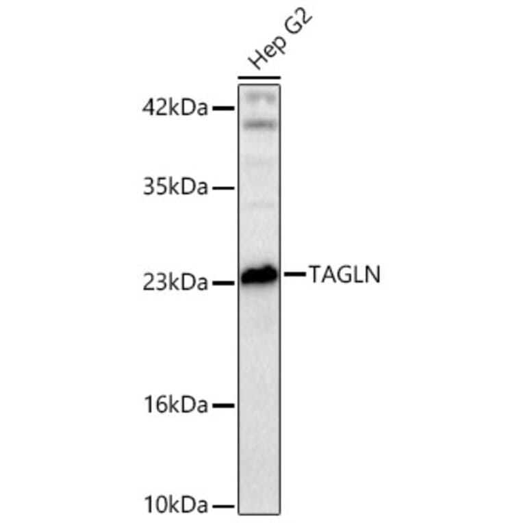 Western Blot - Anti-Transgelin Antibody (A329924) - Antibodies.com