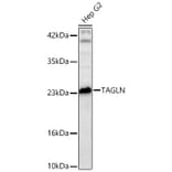 Western Blot - Anti-Transgelin Antibody (A329924) - Antibodies.com