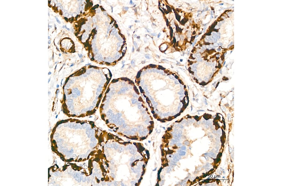 Immunohistochemistry - Anti-Transgelin Antibody (A329924) - Antibodies.com