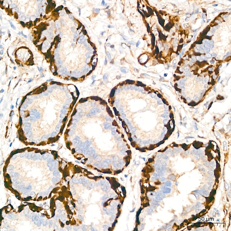 Immunohistochemistry - Anti-Transgelin Antibody (A329924) - Antibodies.com