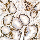 Immunohistochemistry - Anti-Transgelin Antibody (A329924) - Antibodies.com