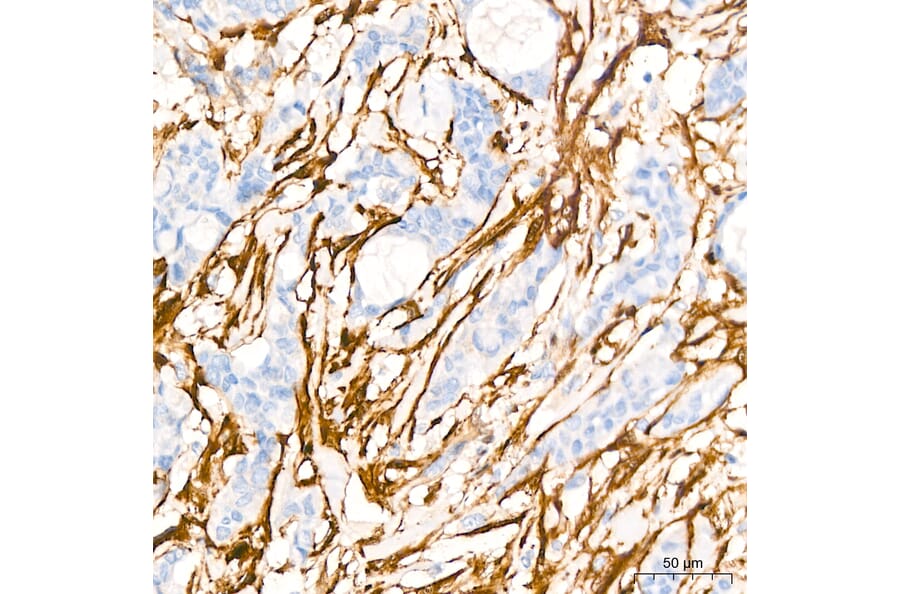 Immunohistochemistry - Anti-Transgelin Antibody (A329924) - Antibodies.com