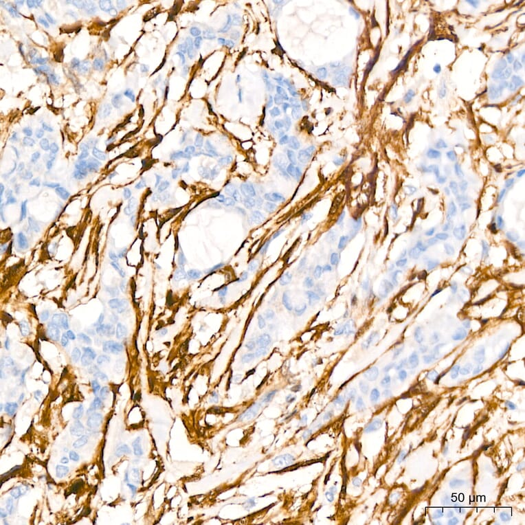 Immunohistochemistry - Anti-Transgelin Antibody (A329924) - Antibodies.com