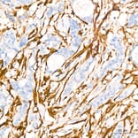 Immunohistochemistry - Anti-Transgelin Antibody (A329924) - Antibodies.com