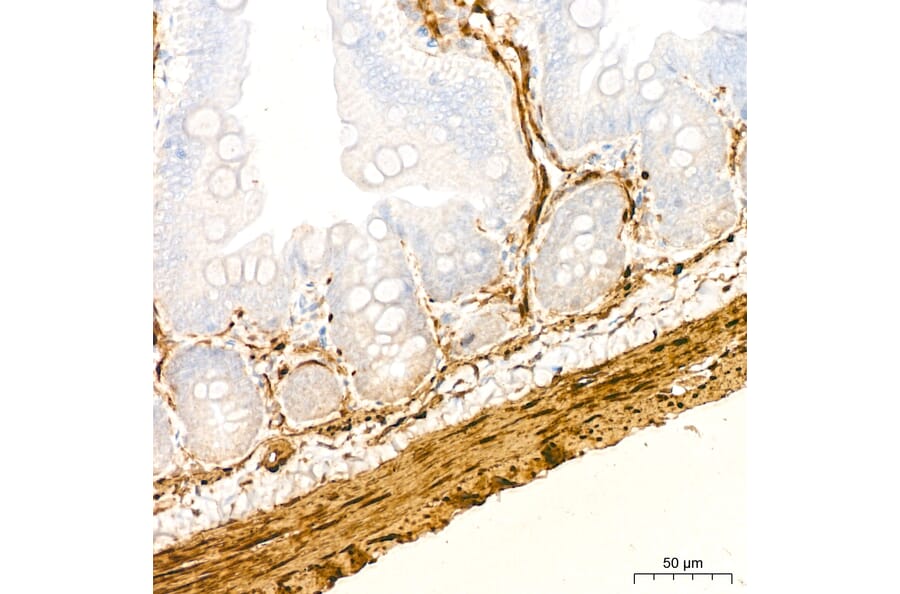 Immunohistochemistry - Anti-Transgelin Antibody (A329924) - Antibodies.com