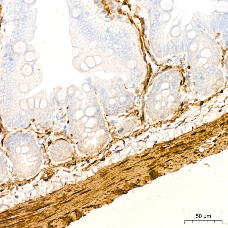 Immunohistochemistry - Anti-Transgelin Antibody (A329924) - Antibodies.com
