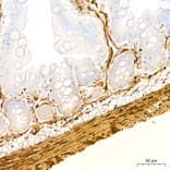 Immunohistochemistry - Anti-Transgelin Antibody (A329924) - Antibodies.com