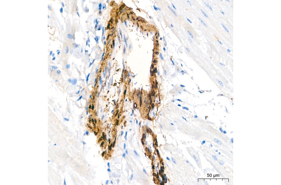 Immunohistochemistry - Anti-Transgelin Antibody (A329924) - Antibodies.com