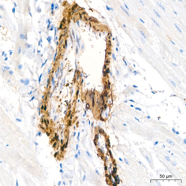 Immunohistochemistry - Anti-Transgelin Antibody (A329924) - Antibodies.com