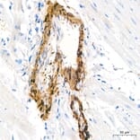 Immunohistochemistry - Anti-Transgelin Antibody (A329924) - Antibodies.com