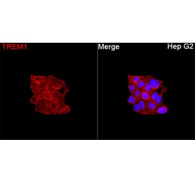 Immunofluorescence - Anti-TREM1 Antibody (A329927) - Antibodies.com