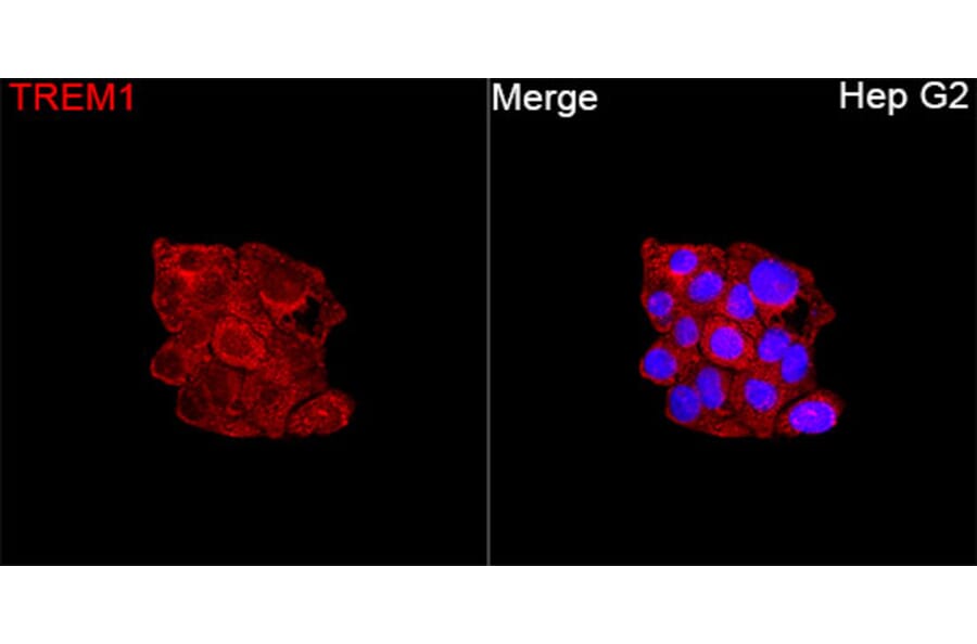 Immunofluorescence - Anti-TREM1 Antibody (A329927) - Antibodies.com