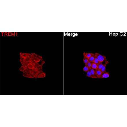 Immunofluorescence - Anti-TREM1 Antibody (A329927) - Antibodies.com