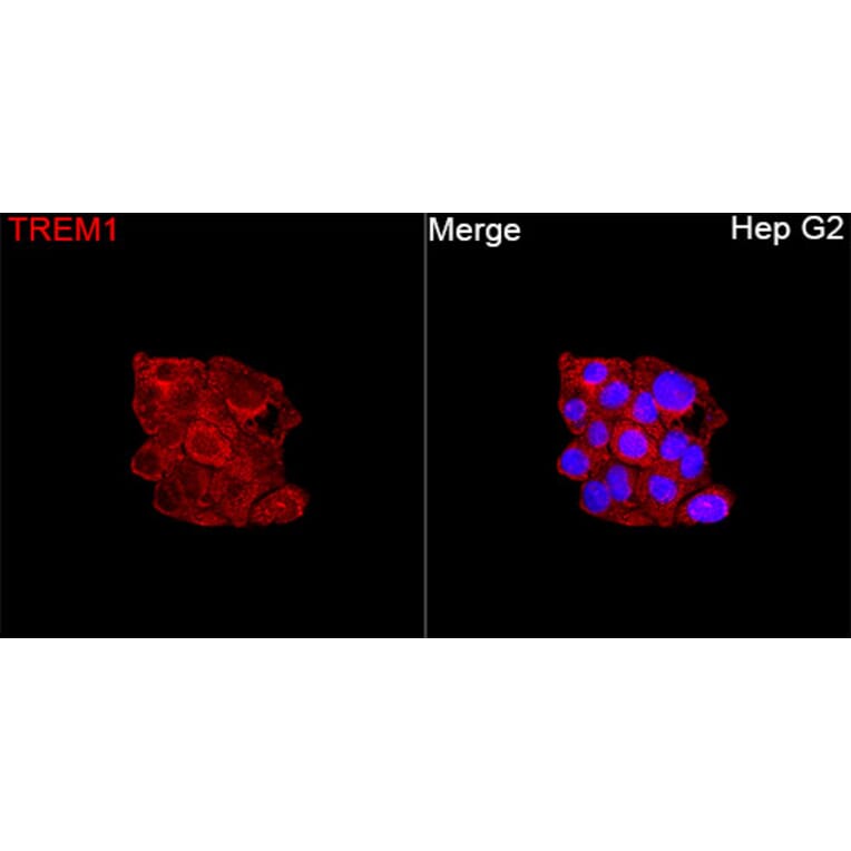 Immunofluorescence - Anti-TREM1 Antibody (A329927) - Antibodies.com