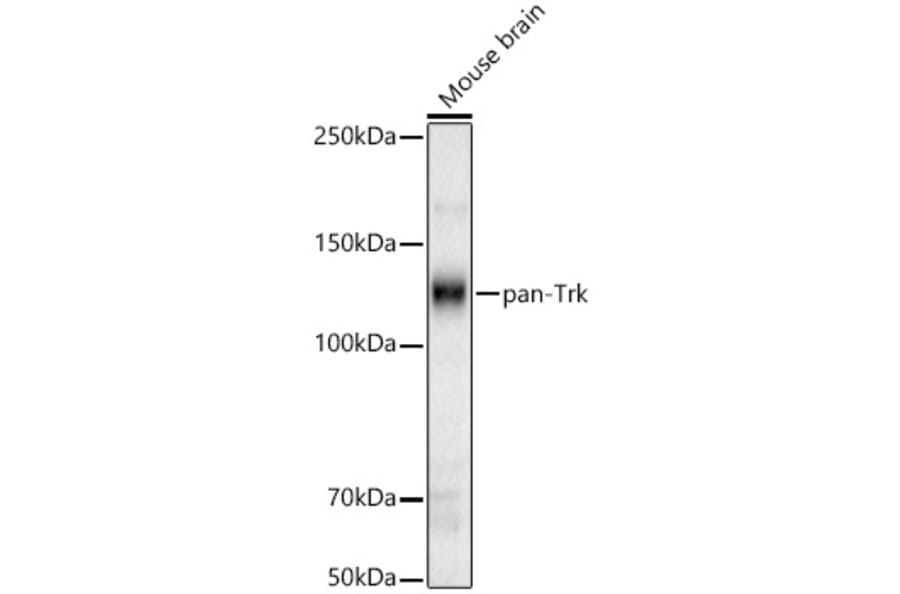 Western Blot - Anti-TrkA Antibody (A329929) - Antibodies.com
